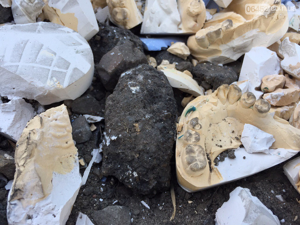 Челюсти вместо асфальта: в Северодонецке засыпали яму зубными протезами